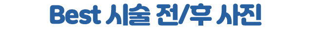 베스트 시술 전/후 사진