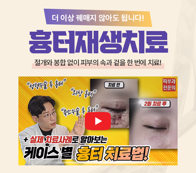 DNA 흉터재생치료 배너