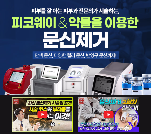 피코웨이 & 문신제거 배너