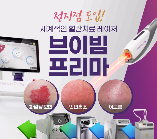브이빔프리마 배너